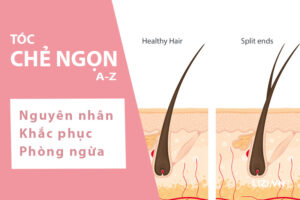 Tóc chẻ ngọn: nguyên nhân, cách khắc phục và phòng ngừa